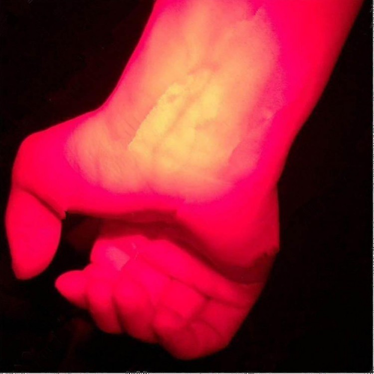 Infrared Blood Vessel Finder Flashlight – Illuminate Vessels